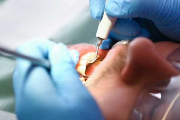 Best Pediatric Emergency Dentist in Sylva, NC