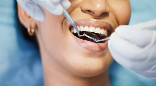 Best Emergency Dentist for Knocked-Out Tooth in Sylva, NC