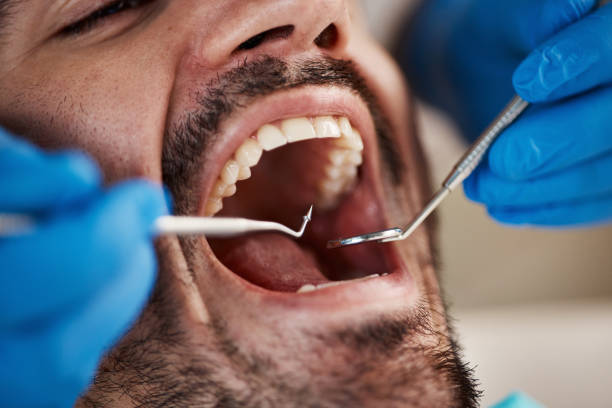 Best Orthodontic Emergency Dentist in Sylva, NC